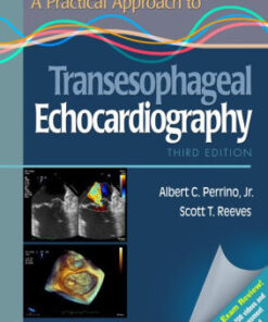 A Practical Approach to Transesophageal Echocardiography 3rd Edition by Albert C. Perrino