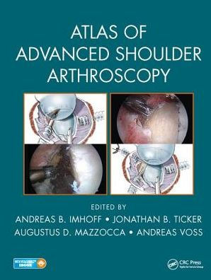 Atlas of Advanced Shoulder Arthroscopy by Andreas B. Imhoff