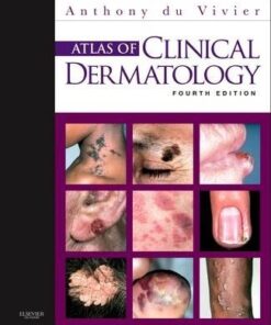 Atlas of Clinical Dermatology 4th Edition by Anthony Du Vivier