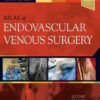 Atlas of Endovascular Venous Surgery 2nd Edition by Almeida