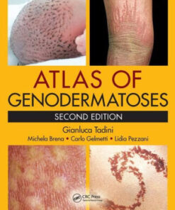 Atlas of Genodermatoses 2nd Edition by Gianluca Tadini