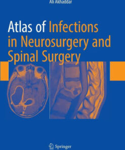 Atlas of Infections in Neurosurgery and Spinal Surgery by Akhaddar