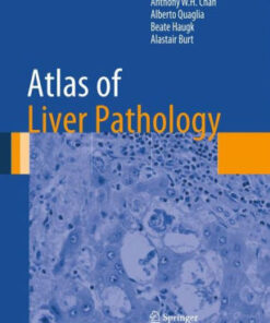 Atlas of Liver Pathology by Anthony W.H. Chan