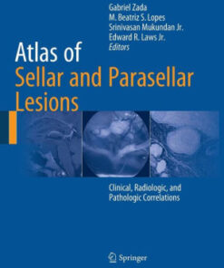 Atlas of Sellar and Parasellar Lesions by Gabriel Zada