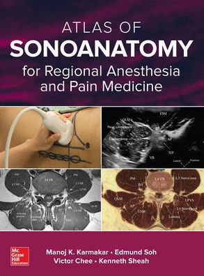 Atlas of Sonoanatomy for Regional Anesthesia by Karmakar