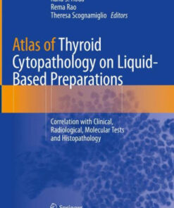 Atlas of Thyroid Cytopathology on Liquid Based Preparations by Hoda