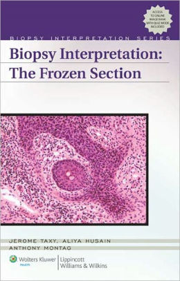 Biopsy Interpretation - The Frozen Section by Jerome B. Taxy