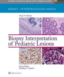 Biopsy Interpretation of Pediatric Lesions by Aliya N. Husain