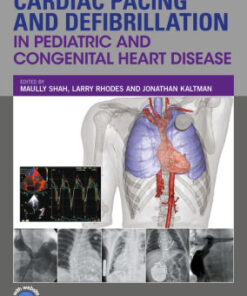 Cardiac Pacing and Defibrillation in Pediatric by Maully Shah