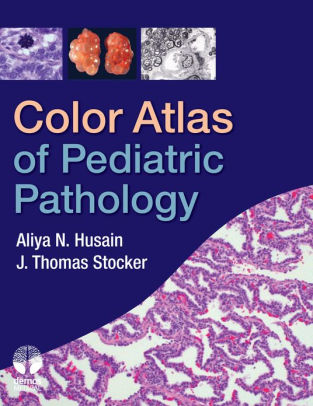 Color Atlas of Pediatric Pathology by Aliya N. Husain