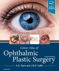 Colour Atlas of Ophthalmic Plastic Surgery 4th Edition by Tyers