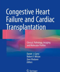 Congestive Heart Failure and Cardiac Transplantation by Daniel J. Garry