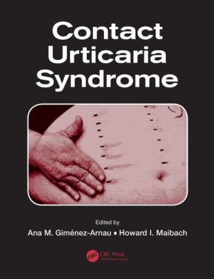 Contact Urticaria Syndrome by Ana M. Gimenez-Arnau