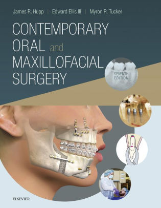 Contemporary Oral and Maxillofacial Surgery 7th Edition by Hupp