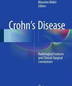 Crohn's Disease - Radiological Features by Giuseppe Lo Re