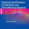 Cutaneous Manifestations of Child Abuse by Robert A.C. Bilo