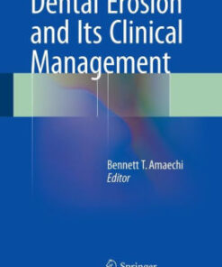 Dental Erosion and Its Clinical Management by Bennett T. Amaechi