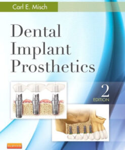 Dental Implant Prosthetics 2nd Edition by Carl E. Misch