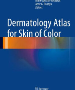 Dermatology Atlas for Skin of Color by Jackson Richards