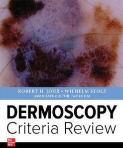 Dermoscopy Criteria Review by Wilhelm Stolz