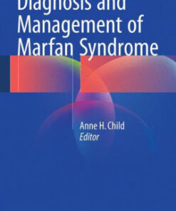 Diagnosis and Management of Marfan Syndrome by Anne H. Child