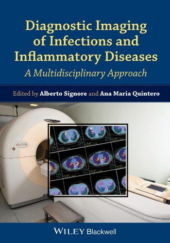 Diagnostic Imaging of Infections and Inflammatory Diseases - A Multidiscplinary Approach by Alberto Signore