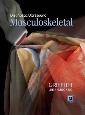 Diagnostic Ultrasound - Musculoskeletal by James F. Griffith