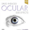 Drug Induced Ocular Side Effects 8th Edition by Fraunfelder