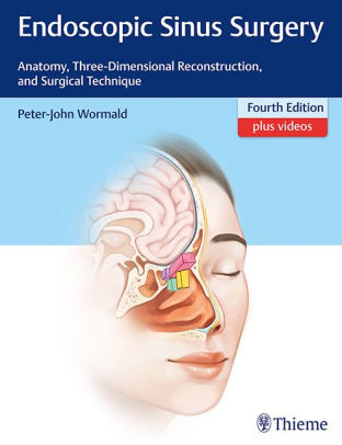 Endoscopic Sinus Surgery - Anatomy 4th Edition by Wormald