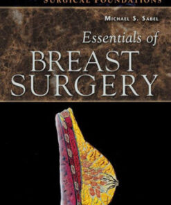 Essentials of Breast Surgery by Michael S. Sabel