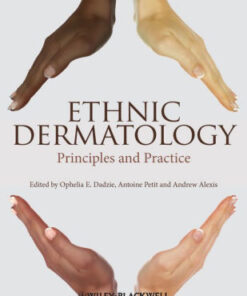 Ethnic Dermatology - Principles and Practice by Ophelia E. Dadzie