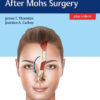 Facial Reconstruction After Mohs Surgery by James Thornton