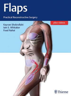 Flaps - Practical Reconstructive Surgery by Shokrollahi