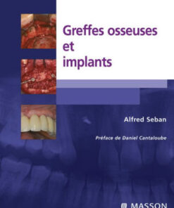Greffes osseuses et implants By Alfred Seban