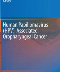 Human Papillomavirus HPV Associated Oropharyngeal Cancer by Miller