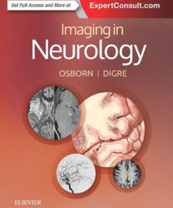 Imaging in Neurology by Anne G. Osborn