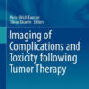 Imaging of Complications and Toxicity following Tumor Therapy by Kauczor