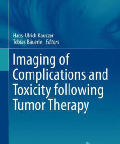 Imaging of Complications and Toxicity following Tumor Therapy by Kauczor