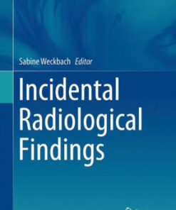 Incidental Radiological Findings by Sabine Weckbach