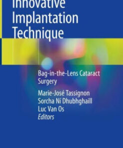 Innovative Implantation Technique by Tassignon