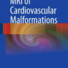 MRI of Cardiovascular Malformations by Bruno Kastler