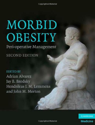 Morbid Obesity Peri operative Management 2nd Edition By Adrian Alvarez