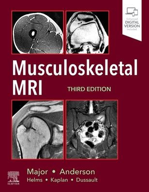Musculoskeletal MRI 3rd Edition by Nancy M. Major