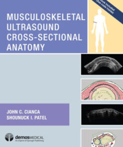 Musculoskeletal Ultrasound Cross-Sectional Anatomy by Cianca