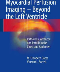 Myocardial Perfusion Imaging - Beyond the Left Ventricle Oates