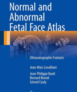 Normal and Abnormal Fetal Face Atlas by Jean-Marc Levaillant