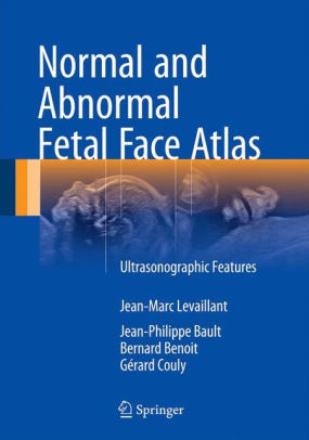 Normal and Abnormal Fetal Face Atlas by Jean-Marc Levaillant