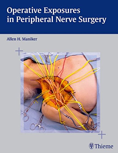 Operative Exposures in Peripheral Nerve Surgery By Allen H. Maniker
