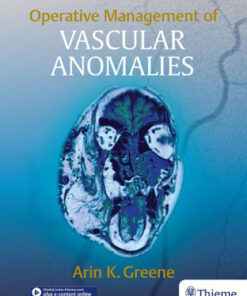 Operative Management of Vascular Anomalies By Arin K. Greene
