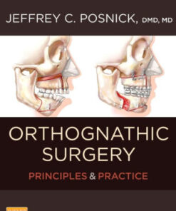 Orthognathic Surgery - Principles and Practice 2 Vol Set by Posnick